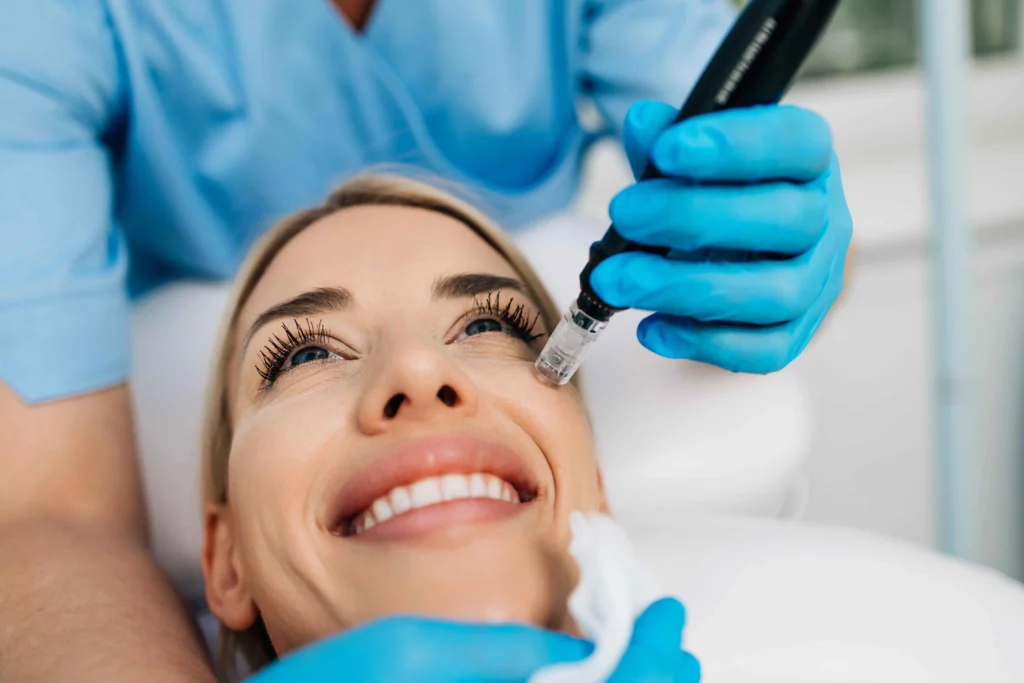 Microneedling with PRP Take Away Dark Spots