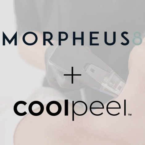 Morpheus8 and CoolPeel Treatment By Enchanted Medical Aesthetics