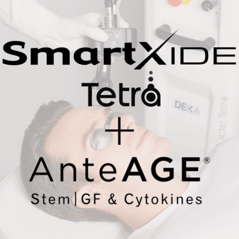SmartXide Tetra and AnteAge By Enchanted Medical Aesthetics