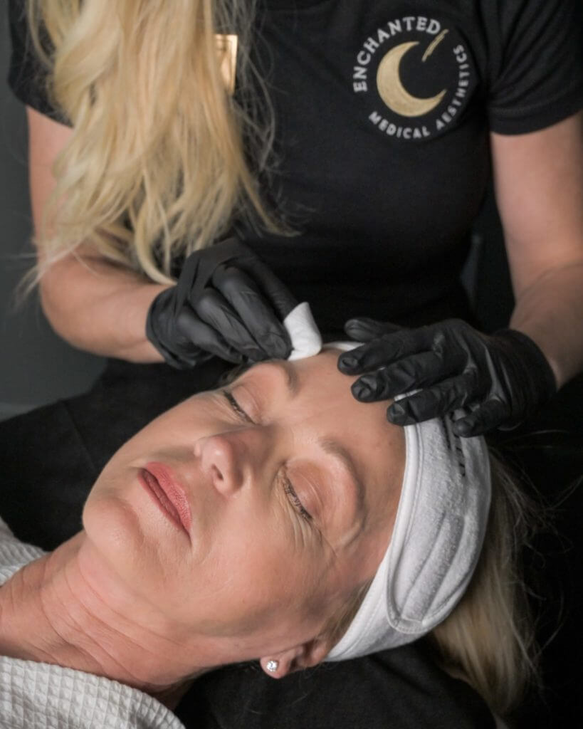 Chemical Peels By Enchanted Medical Aesthetics