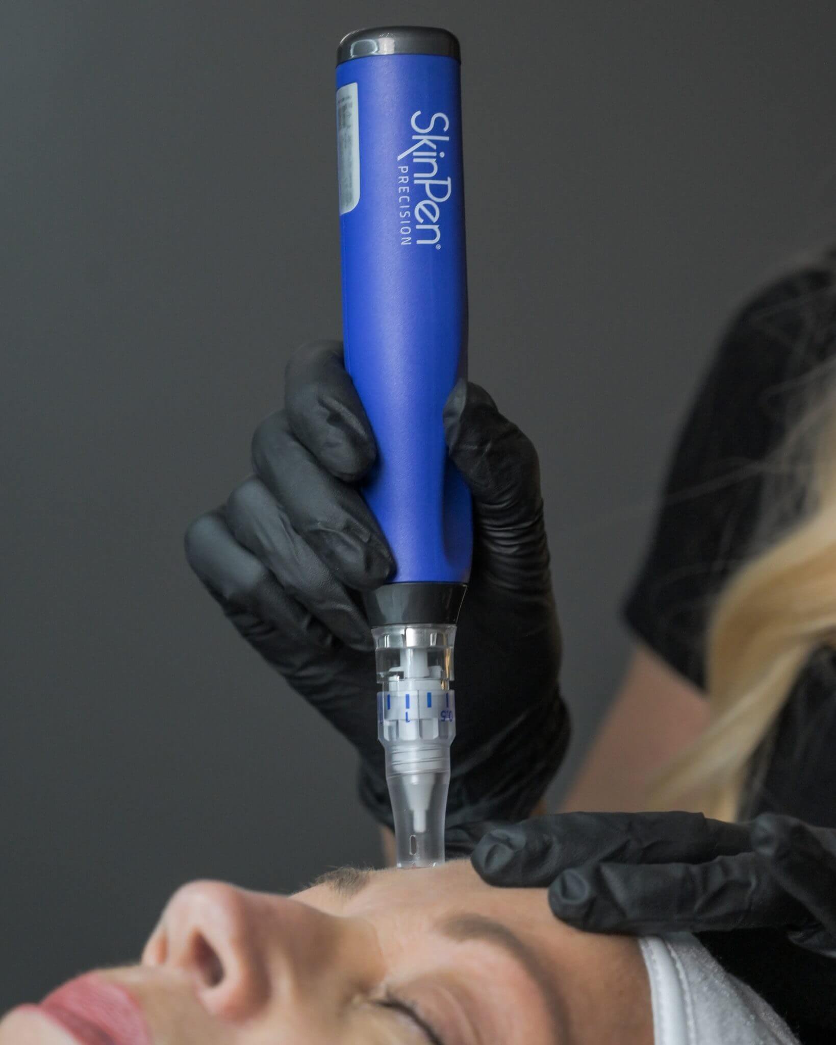 Skinpen Microneedling By Enchanted Medical Aesthetics