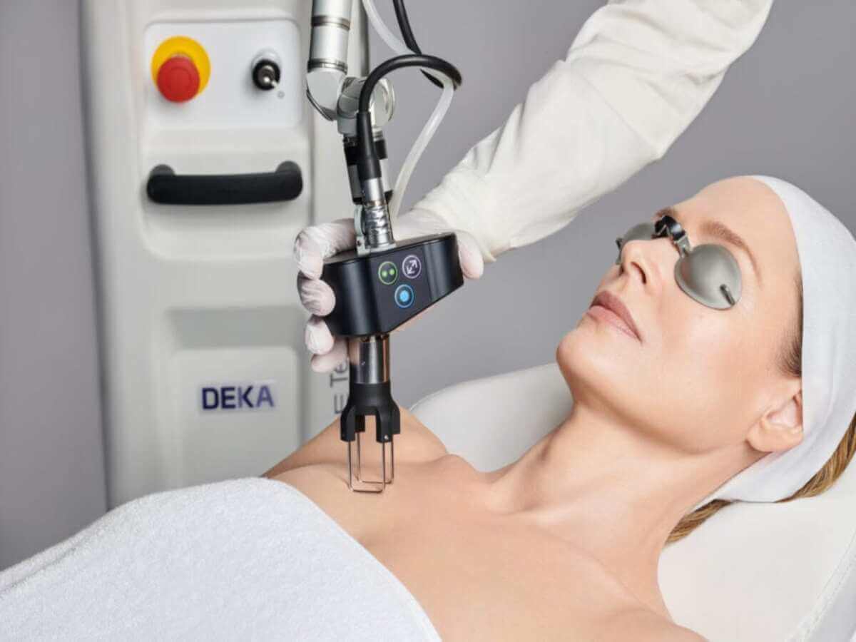 Coolpeel Laser Treatment by Enchanted Medical Aesthetics