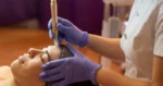 Microneedling with PRP and PRF by Enchanted Medical Aesthetics in Ormond Beach, FL