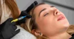 Hair Restoration Treatment by Enchanted Medical Aesthetics in Ormond Beach, FL