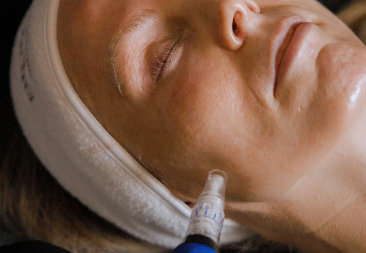 PRF/PRP Injections at Enchanted Medical Aesthetics in DeLand