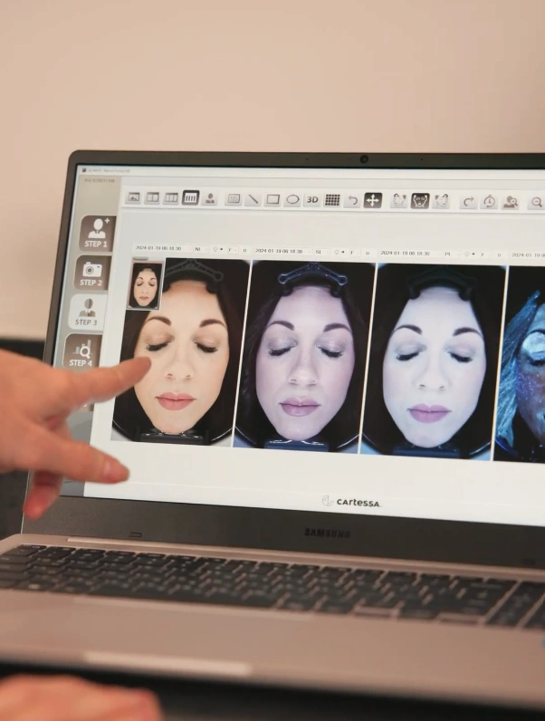 Facial Analyzer