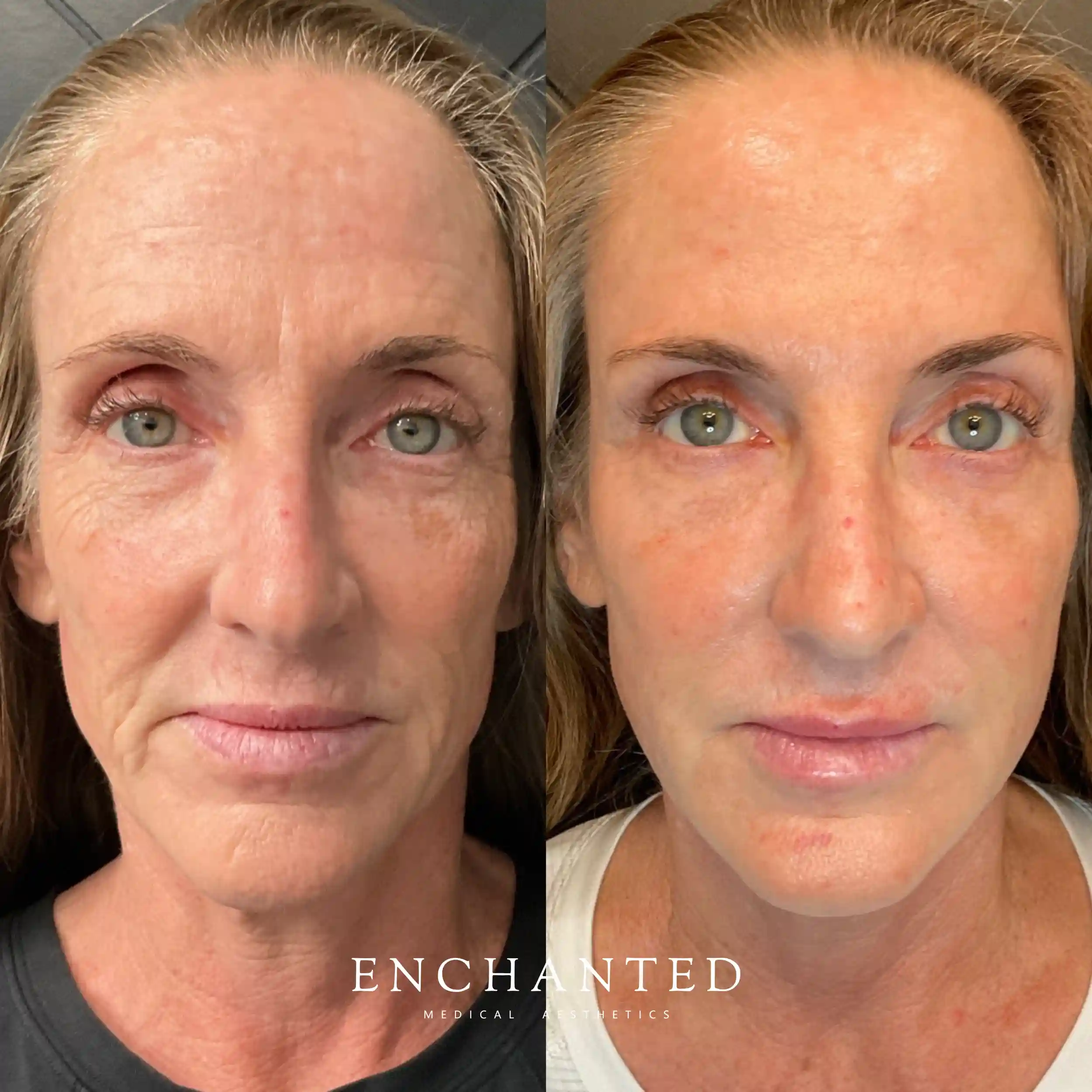 Facial Balancing