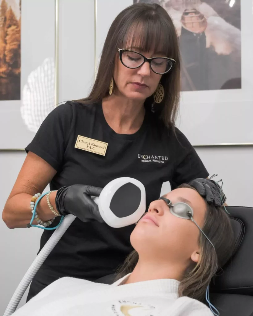 Lumecca IPL Photofacial