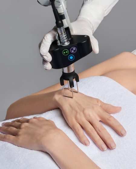 CoolPeel-Treatment-CoolPeel-Hands-in-ormond-beach-fl