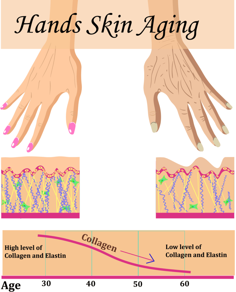 Hand Rejuvenation By Enchanted Medical Aesthetics