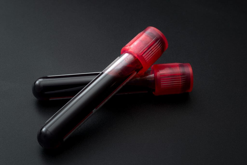 PRF Treatment By Enchanted Medical Aesthetics