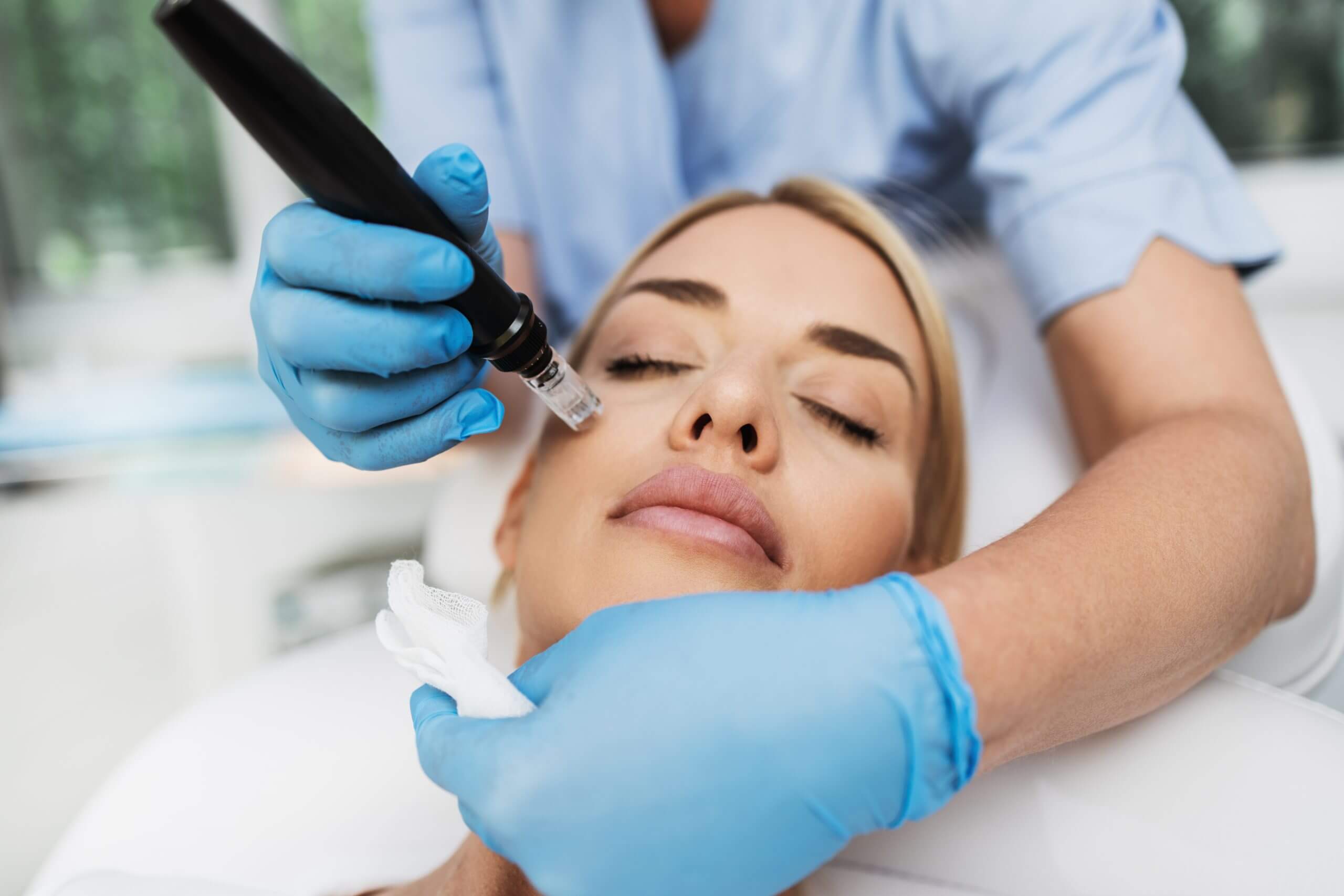 Microneedling Vs RF Microneedling