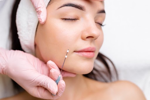 Threadlift By Enchanted Medical Aesthetics