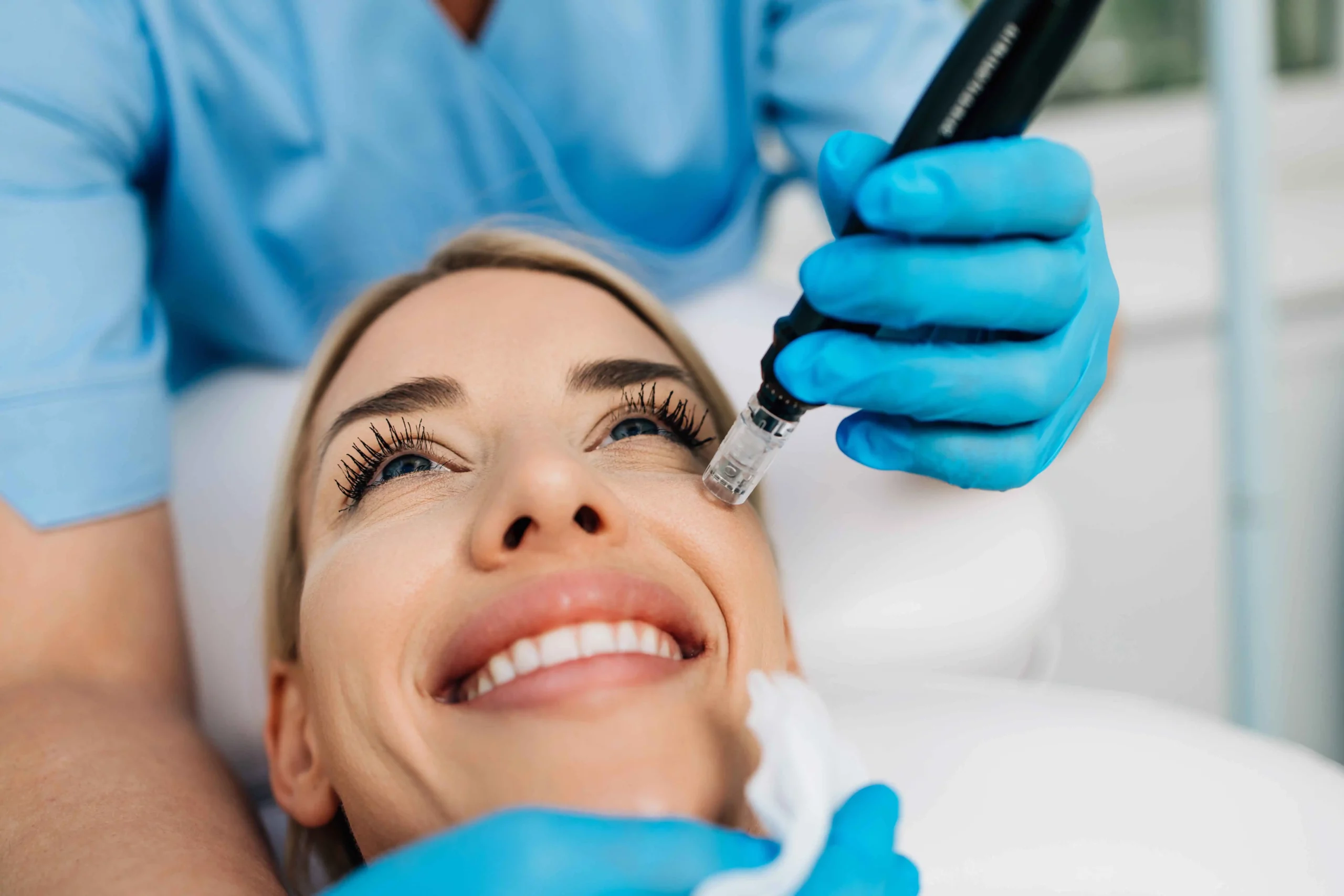 Microneedling with PRP Take Away Dark Spots