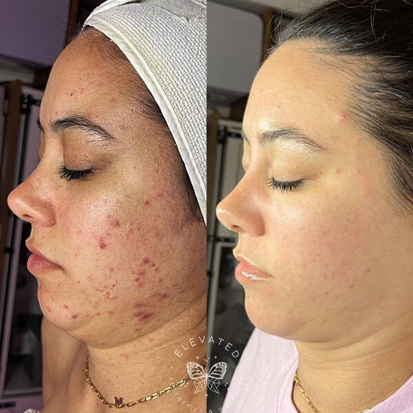 3 Blue Sessions Before & After