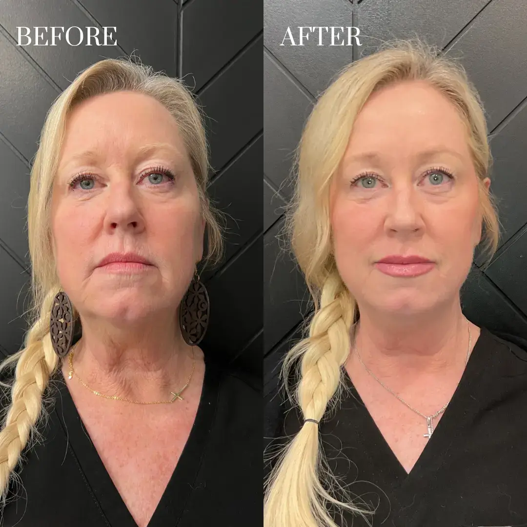 enchanted before after eight feb