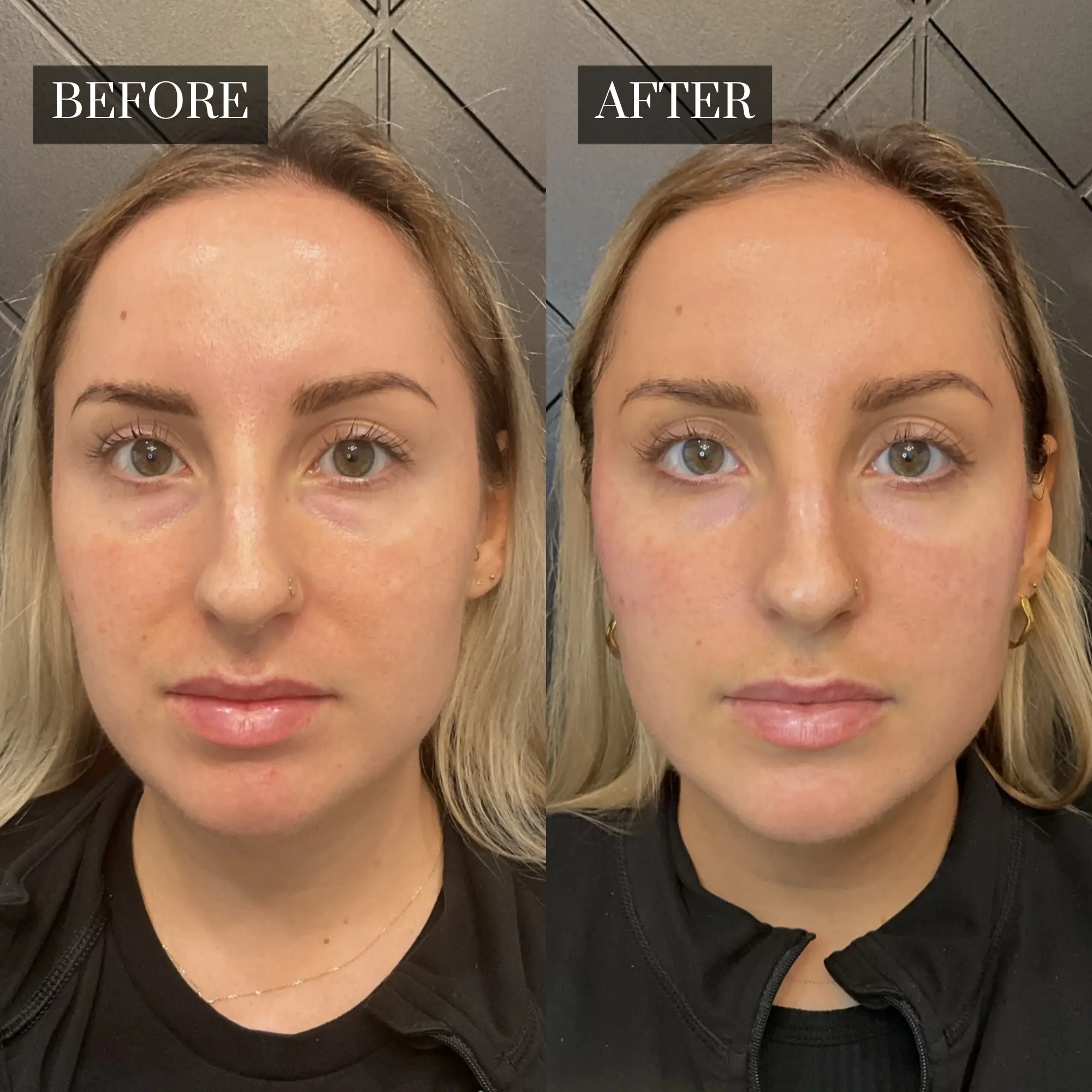 Before & After