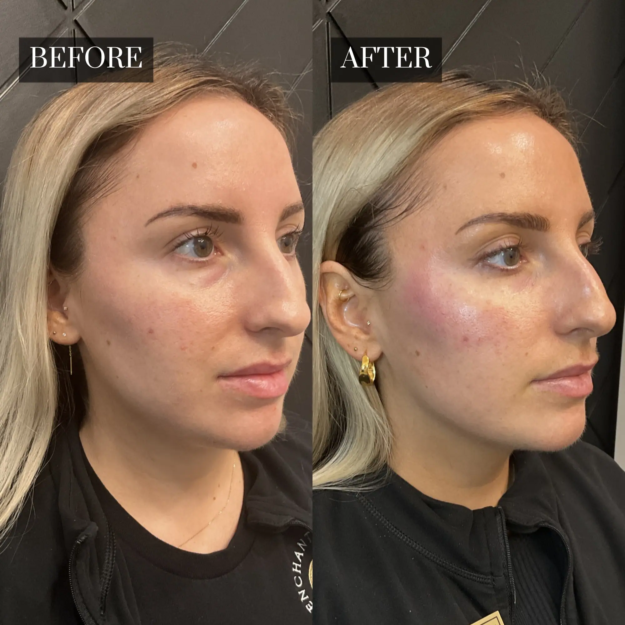 Before & After