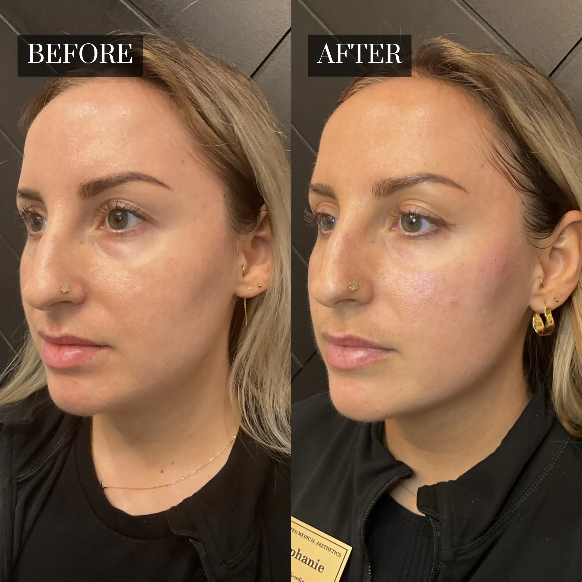 Before & After