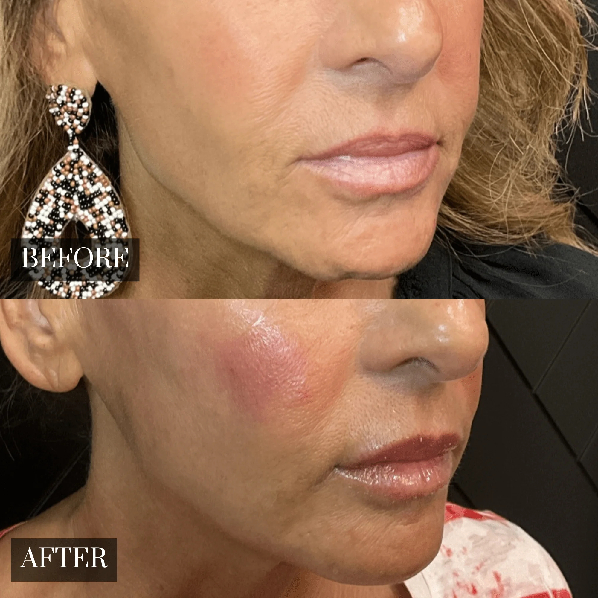 Before & After