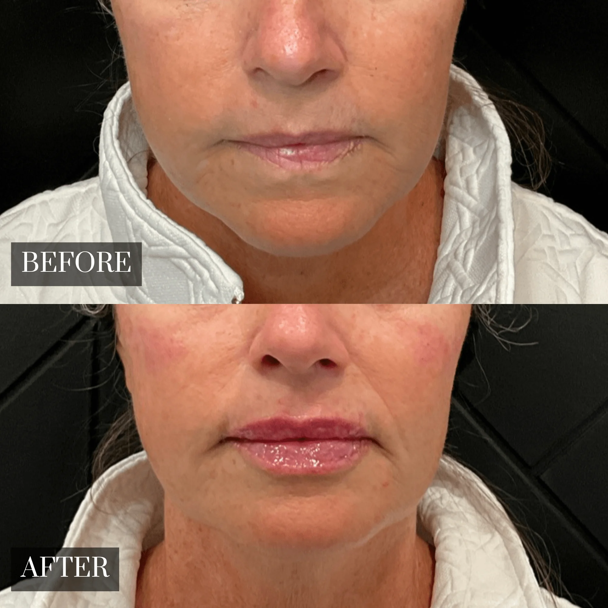 Before & After