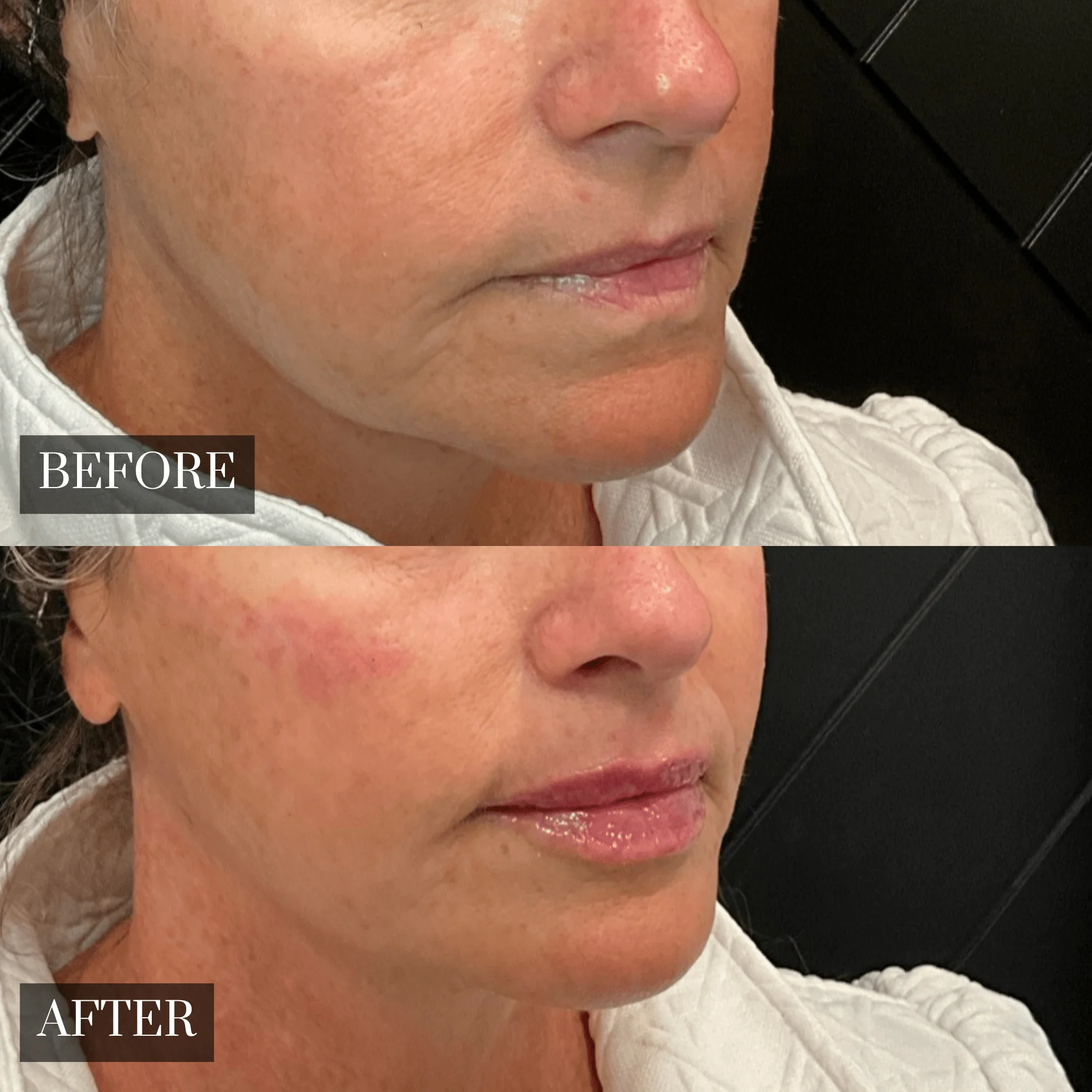 Before & After