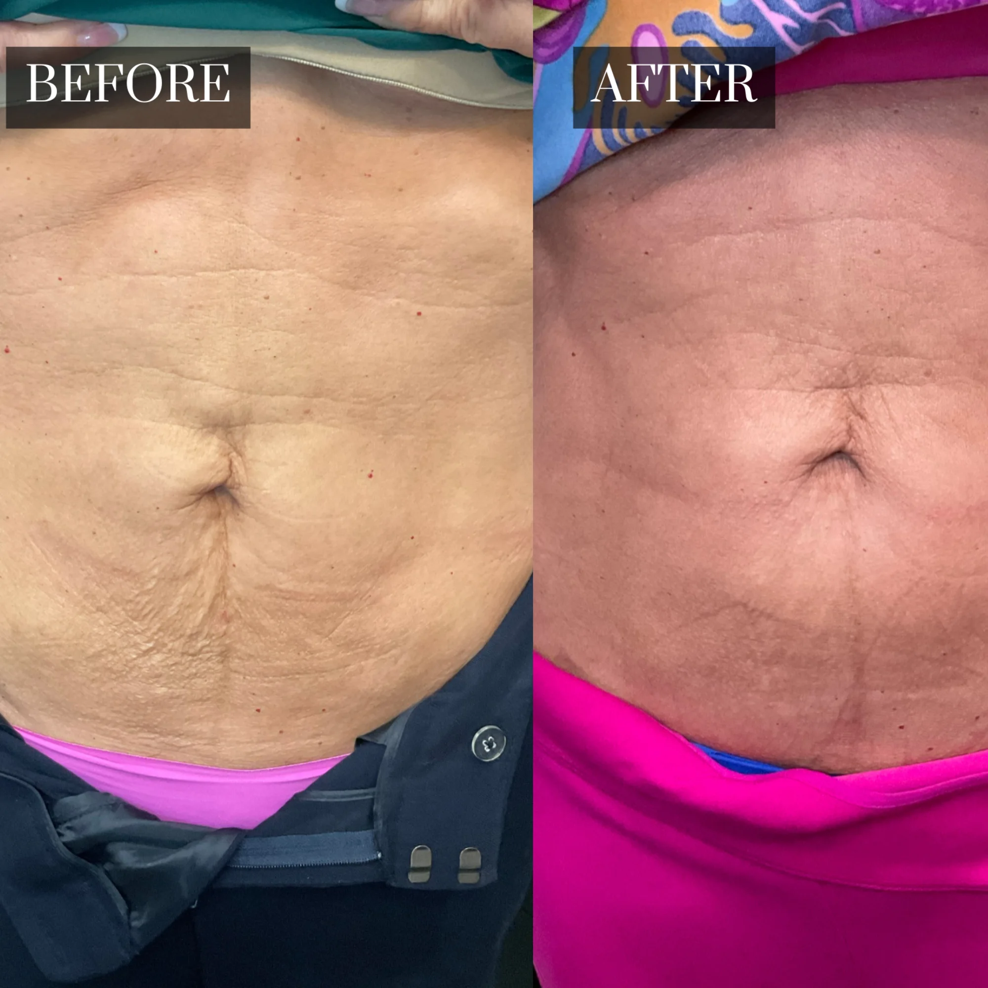 See the Stunning Results of Smooth PDO Threads at Enchanted!