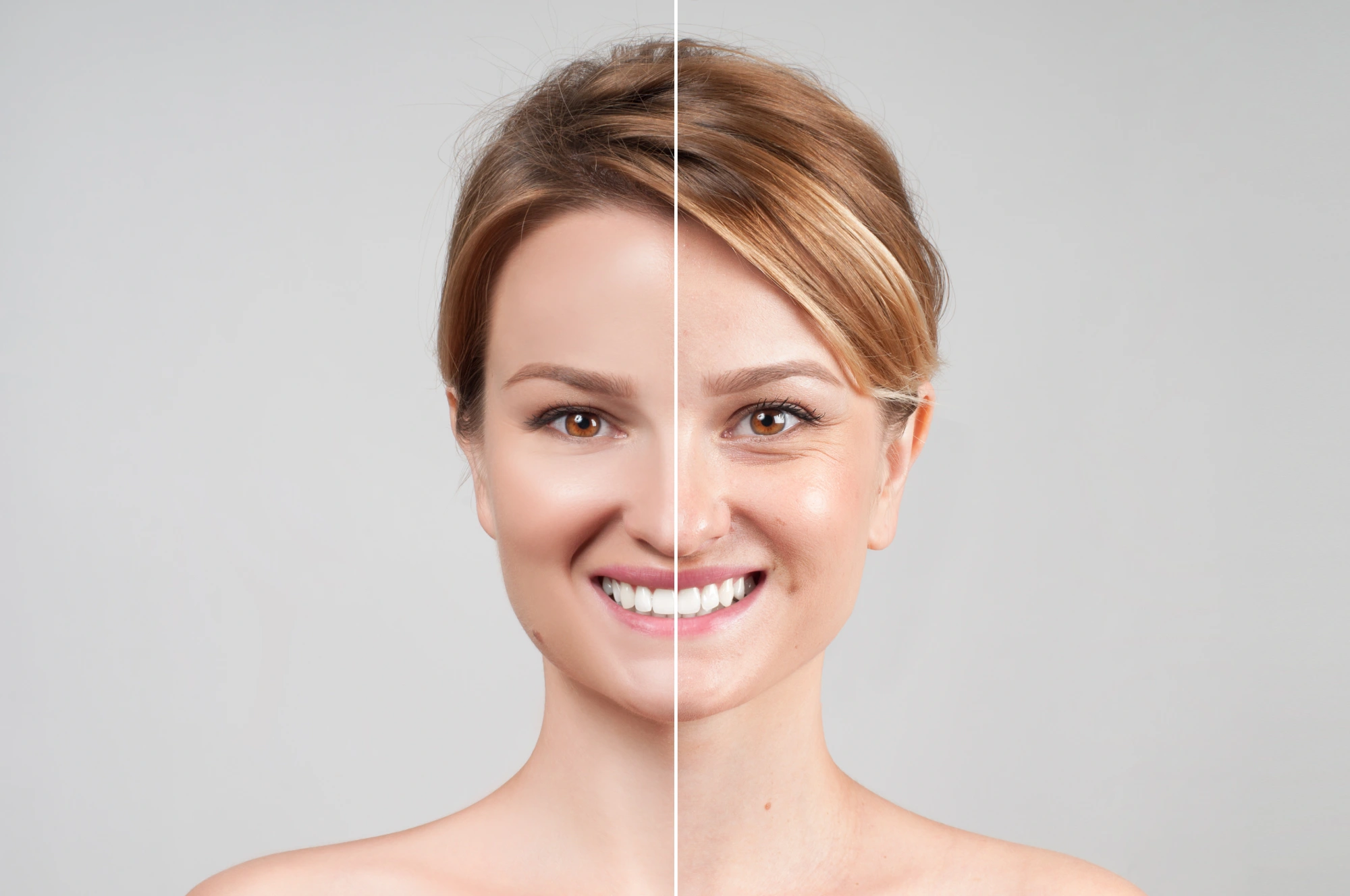 Is Radiesse the Treatment for you?