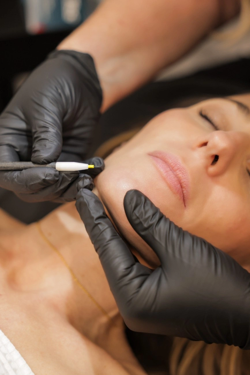 Electrolysis Hair Removal Treatment in Ormond Beach, FL