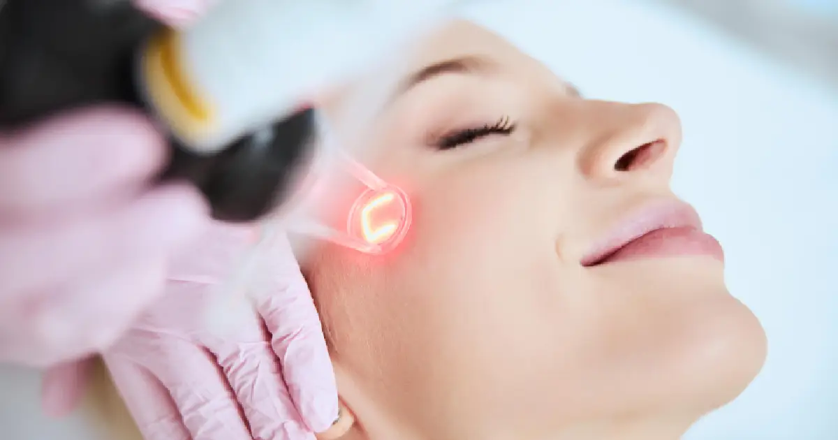 Laser Skin Resurfacing Treatment in Ormond Beach, FL