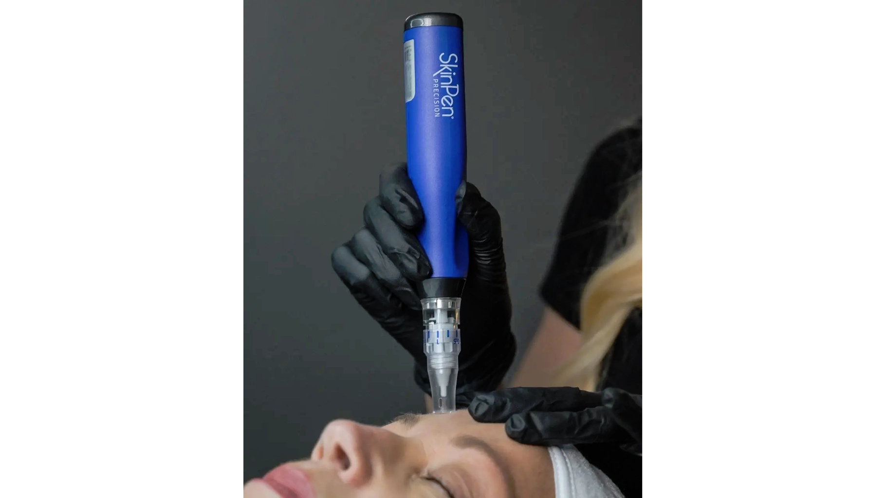 Microneedling With PRP in Ormond Beach, FL