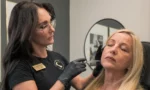 10 Benefits of Dermal Fillers for facial contouring