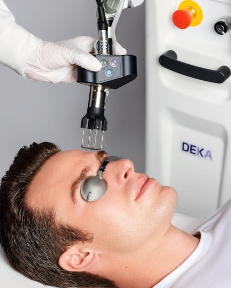 Coolpeel Treatment By Enchanted Medical Aesthetics
