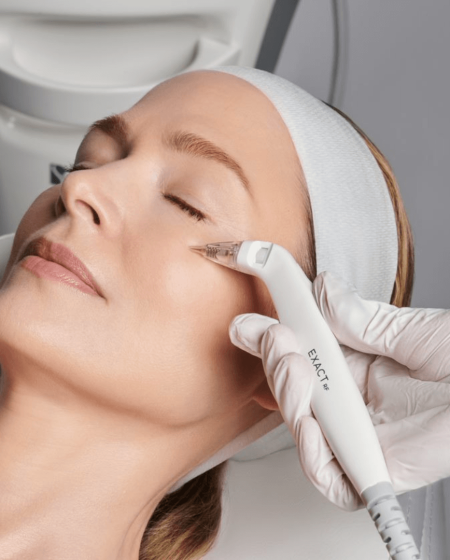 Virtue RF Microneedling By Enchanted Medical Aesthetics